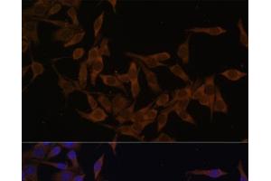 Immunofluorescence analysis of HeLa cells using UBE2L3 Polyclonal Antibody at dilution of 1:100 (40x lens). (UBE2L3 antibody)