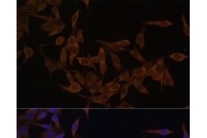 Immunofluorescence analysis of HeLa cells using UBE2L3 Polyclonal Antibody at dilution of 1:100 (40x lens). (UBE2L3 antibody)