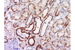 Paraformaldehyde-fixed, paraffin embedded human kidney, Antigen retrieval by boiling in sodium citrate buffer (pH6) for 15min, Block endogenous peroxidase by 3% hydrogen peroxide for 30 minutes, Blocking buffer (normal goat serum) at 37°C for 20min, Antibody incubation with Rabbit Anti-Caspase-10 Polyclonal Antibody, Unconjugated  at 1:500 overnight at 4°C, followed by a conjugated secondary and DAB staining. (Caspase 10 antibody  (AA 431-521))