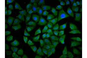 Immunofluorescence staining of Hela cells with ABIN7160104 at 1:133, counter-stained with DAPI. (MKL1 antibody  (AA 674-812))