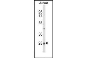 Western blot analysis of CTDSP1 Antibody (N-term) in Jurkat cell line lysates (35ug/lane).