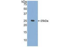 Detection of Recombinant CRADD, Human using Polyclonal Antibody to CASP2 And RIPK1 Domain Containing Adaptor With Death Domain Protein (CRADD) (CRADD antibody  (AA 1-199))