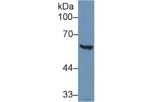 Western Blotting (WB) image for anti-Glucose-6-Phosphate Dehydrogenase (G6PD) (AA 1-515) antibody (ABIN1173474)