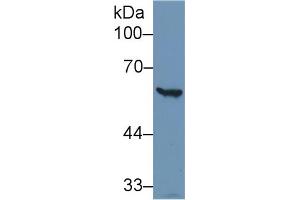 Western Blot; Sample: Human Hela cell lysate; Primary Ab: 1µg/ml Rabbit Anti-Human G6PD Antibody Second Ab: 0.