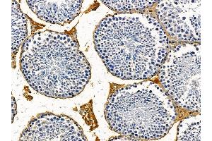 ABIN7095603 and ABIN7099665 at 1/100 staining mouse testis tissue by IHC-P. (ANP32E antibody)