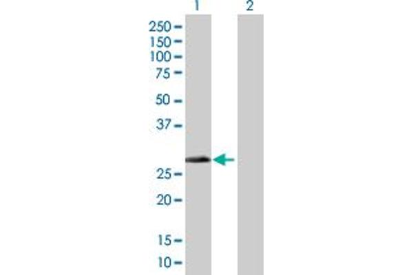 DHRS4 antibody  (AA 1-278)