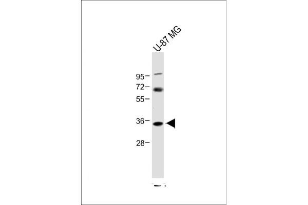 NAT8L anticorps  (AA 59-93)