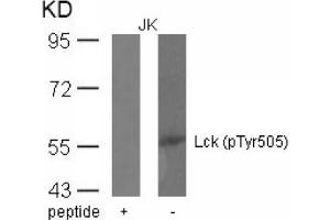 Image no. 1 for anti-Lymphocyte-Specific Protein tyrosine Kinase (LCK) (pTyr505) antibody (ABIN401553) (LCK antibody  (pTyr505))