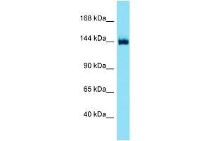 Host: Rabbit  Target Name: Dgkd  Sample Tissue: Mouse Liver lysates  Antibody Dilution: 1.