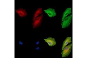 ABIN7096957 and ABIN7101024 staining  cells by IF/ICC.