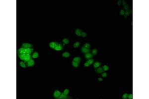 Immunofluorescent analysis of PC-3 cells using ABIN7172771 at dilution of 1:100 and Alexa Fluor 488-congugated AffiniPure Goat Anti-Rabbit IgG(H+L) (ERG antibody  (AA 1-486))