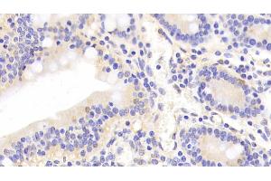 Immunohistochemistry (IHC) image for anti-Annexin A4 (ANXA4) (AA 3-151) antibody (ABIN7437596)