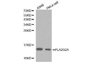 Western Blotting (WB) image for anti-Phospholipase A2, Group IIA (Platelets, Synovial Fluid) (PLA2G2A) (AA 21-144) antibody (ABIN3021802)