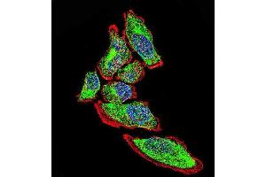 Confocal immunofluorescent analysis of Vimentin Antibody with A549 cell followed by Alexa Fluor 488-conjugated goat anti-rabbit lgG (green). (Vimentin antibody)