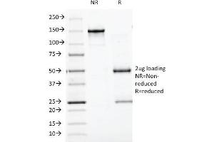 SDS-PAGE Analysis Purified Chromogranin A Monoclonal Antibody (CGA/413). (Chromogranin A antibody)