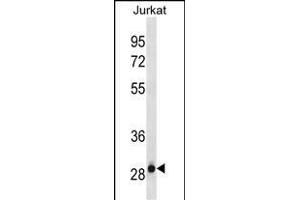 HAGH Antibody (C-term)(Ascites) ABIN1882252 western blot analysis in Jurkat cell line lysates (35 μg/lane). (HAGH antibody  (C-Term))