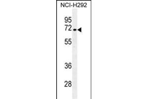 NUMB Antibody (N-term) (ABIN655396 and ABIN2844944) western blot analysis in NCI- cell line lysates (35 μg/lane).