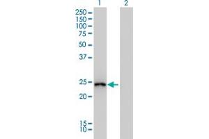 Western Blot analysis of GSTA1 expression in transfected 293T cell line by GSTA1 monoclonal antibody (M01), clone 2F7.