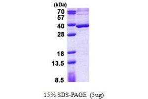 SDS-PAGE (SDS) image for Stanniocalcin 2 (STC2) (AA 25-302) protein (His tag) (ABIN5853017)