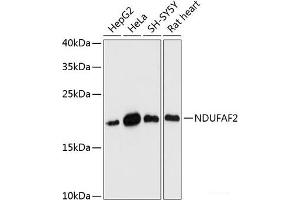 Western blot analysis of extracts of various cell lines using NDUFAF2 Polyclonal Antibody at dilution of 1:3000.