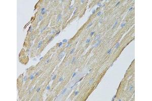 Immunohistochemistry of paraffin-embedded Mouse heart using CKMT2 Polyclonal Antibody at dilution of 1:100 (40x lens). (CKMT2 antibody)