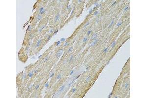 Immunohistochemistry of paraffin-embedded Mouse heart using CKMT2 Polyclonal Antibody at dilution of 1:100 (40x lens).