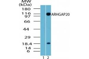 Image no. 3 for anti-rho GTPase Activating Protein 20 (ARHGAP20) (AA 570-620) antibody (ABIN207767) (ARHGAP20 antibody  (AA 570-620))