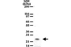 Western blot analysis of PGLYRP1 in tissue lysates from mouse spleen using PGLYRP1 monoclonal antibody, clone 188C424  at a dilution of 2 ug/mL . (PGLYRP1 antibody  (AA 165-180))