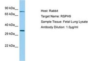 Image no. 1 for anti-Radial Spoke Head 9 Homolog (RSPH9) (AA 99-148) antibody (ABIN6749894) (RSPH9 antibody  (AA 99-148))