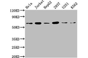 Western Blot Positive WB detected in: Hela whole cell lysate, Jurkat whole cell lysate, HepG2 whole cell lysate, 293T whole cell lysate, U251 whole cell lysate, K562 whole cell lysate All lanes: NUP58 antibody at 1:2000 Secondary Goat polyclonal to rabbit IgG at 1/50000 dilution Predicted band size: 61, 51, 60 kDa Observed band size: 65 kDa (NUPL1 antibody  (AA 211-480))