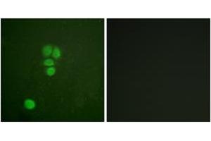 Immunofluorescence analysis of A549 cells, using SOX9 (Ab-181) Antibody. (SOX9 antibody  (AA 147-196))