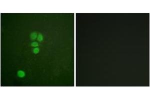 Immunofluorescence analysis of A549 cells, using SOX9 (Ab-181) Antibody.