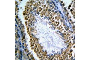 Immunohistochemical analysis of GANP staining in human tonsil formalin fixed paraffin embedded tissue section. (GANP antibody  (C-Term))