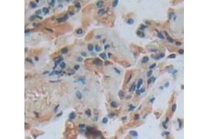Figure. (IL18BP antibody  (AA 31-194))