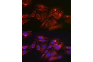 Immunofluorescence analysis of U2OS cells using Raptor Rabbit pAb (ABIN7269901) at dilution of 1:50 (40x lens).