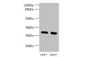 Western blot All lanes: TMEM38B antibody at 1. (TMEM38B antibody  (AA 249-291))