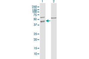 Western Blot analysis of PPIL5 expression in transfected 293T cell line by PPIL5 MaxPab polyclonal antibody.