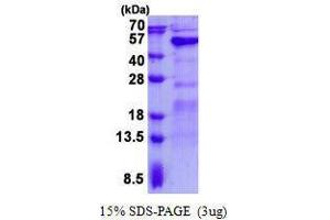 Figure annotation denotes ug of protein loaded and % gel used. (GALT Protein)