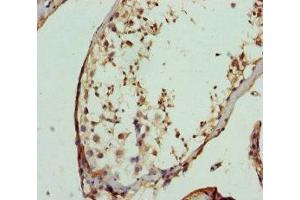 Immunohistochemistry of paraffin-embedded human testis tissue using ABIN7152450 at dilution of 1:100 (FBXO7 antibody  (AA 353-522))