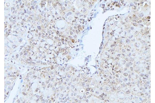 MRPS21 antibody  (C-Term)
