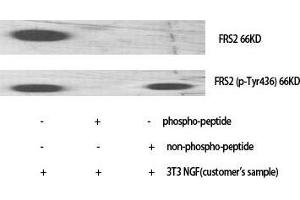 Western Blot (WB) analysis of specific cells using Phospho-FRS2 (Y436) Polyclonal Antibody.