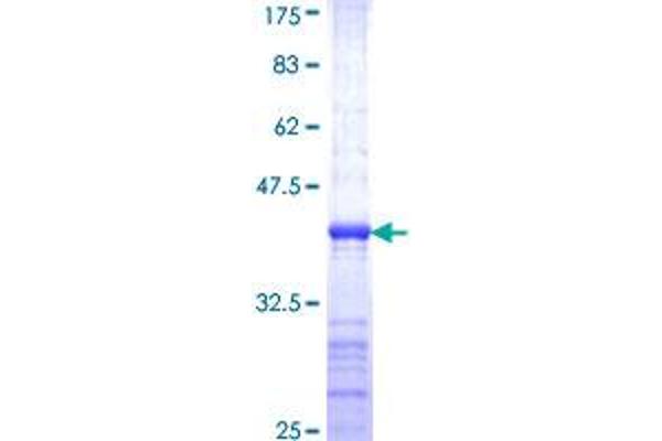 ASCL1 Protein (AA 137-236) (GST tag)