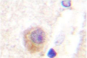 Image no. 2 for anti-Rabphilin 3A (RPH3A) antibody (ABIN272075)