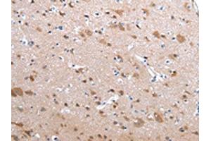 The image on the left is immunohistochemistry of paraffin-embedded Human brain tissue using ABIN7190229(CFC1 Antibody) at dilution 1/20, on the right is treated with synthetic peptide. (CFC1 antibody)