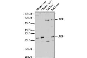 Western blot analysis of extracts of various cell lines, using cFLIP antibody (ABIN3016246, ABIN3016247, ABIN3016248 and ABIN6219655) at 1:1000 dilution.