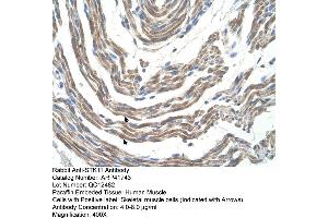 Rabbit Anti-STK11 Antibody  Paraffin Embedded Tissue: Human Muscle Cellular Data: Skeletal muscle cells Antibody Concentration: 4. (LKB1 antibody  (N-Term))