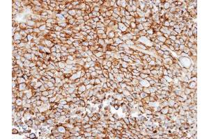 IHC-P Image Immunohistochemical analysis of paraffin-embedded H1299 xenograft, using GRK3, antibody at 1:100 dilution. (ADRBK2 antibody  (N-Term))