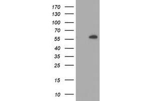 HEK293T cells were transfected with the pCMV6-ENTRY control (Left lane) or pCMV6-ENTRY AKT1 (Right lane) cDNA for 48 hrs and lysed. (AKT1 antibody)