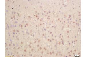 Formalin-fixed and paraffin embedded rat brain labeled with Anti-HES1 Polyclonal Antibody, Unconjugated  at 1:200 followed by conjugation to the secondary antibody and DAB staining (HES1 antibody  (AA 41-150))