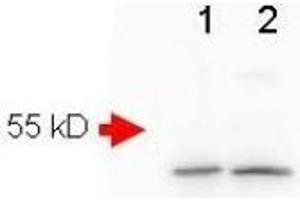 Image no. 3 for anti-Amyloid beta (Abeta) (AA 1-14), (N-Term) antibody (ABIN401205) (beta Amyloid antibody  (N-Term))